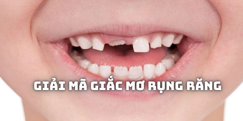 Giải thích sơ lược về chiêm bao bị rụng răng